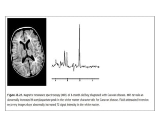 MR Spectroscopy | PPTX
