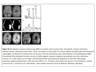 MR Spectroscopy | PPTX