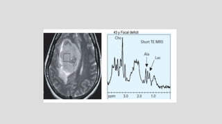 Mr spectroscopy.......................pptx
