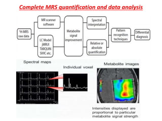 Complete MRS quantification and data analysis
 