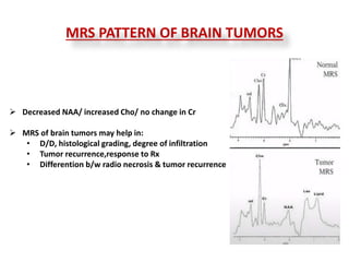 MRS PATTERN OF BRAIN TUMORS
 Decreased NAA/ increased Cho/ no change in Cr
 MRS of brain tumors may help in:
• D/D, histological grading, degree of infiltration
• Tumor recurrence,response to Rx
• Differention b/w radio necrosis & tumor recurrence
 