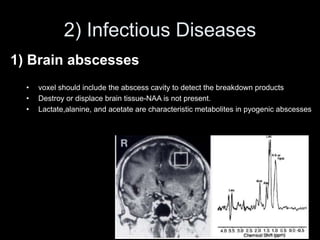 2) Infectious Diseases
1) Brain abscesses
• voxel should include the abscess cavity to detect the breakdown products
• Destroy or displace brain tissue-NAA is not present.
• Lactate,alanine, and acetate are characteristic metabolites in pyogenic abscesses
 