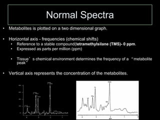 Normal Spectra
• Metabolites is plotted on a two dimensional graph.
• Horizontal axis - frequencies (chemical shifts)
• Reference to a stable compound(tetramethylsilane (TMS)- 0 ppm.
• Expressed as parts per million (ppm)
• Tissue’s chemical environment determines the frequency of a “metabolite
peak”
• Vertical axis represents the concentration of the metabolites.
 