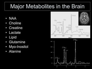 Major Metabolites in the Brain
• NAA
• Choline
• Creatine
• Lactate
• Lipid
• Glutamine
• Myo-Inositol
• Alanine
 