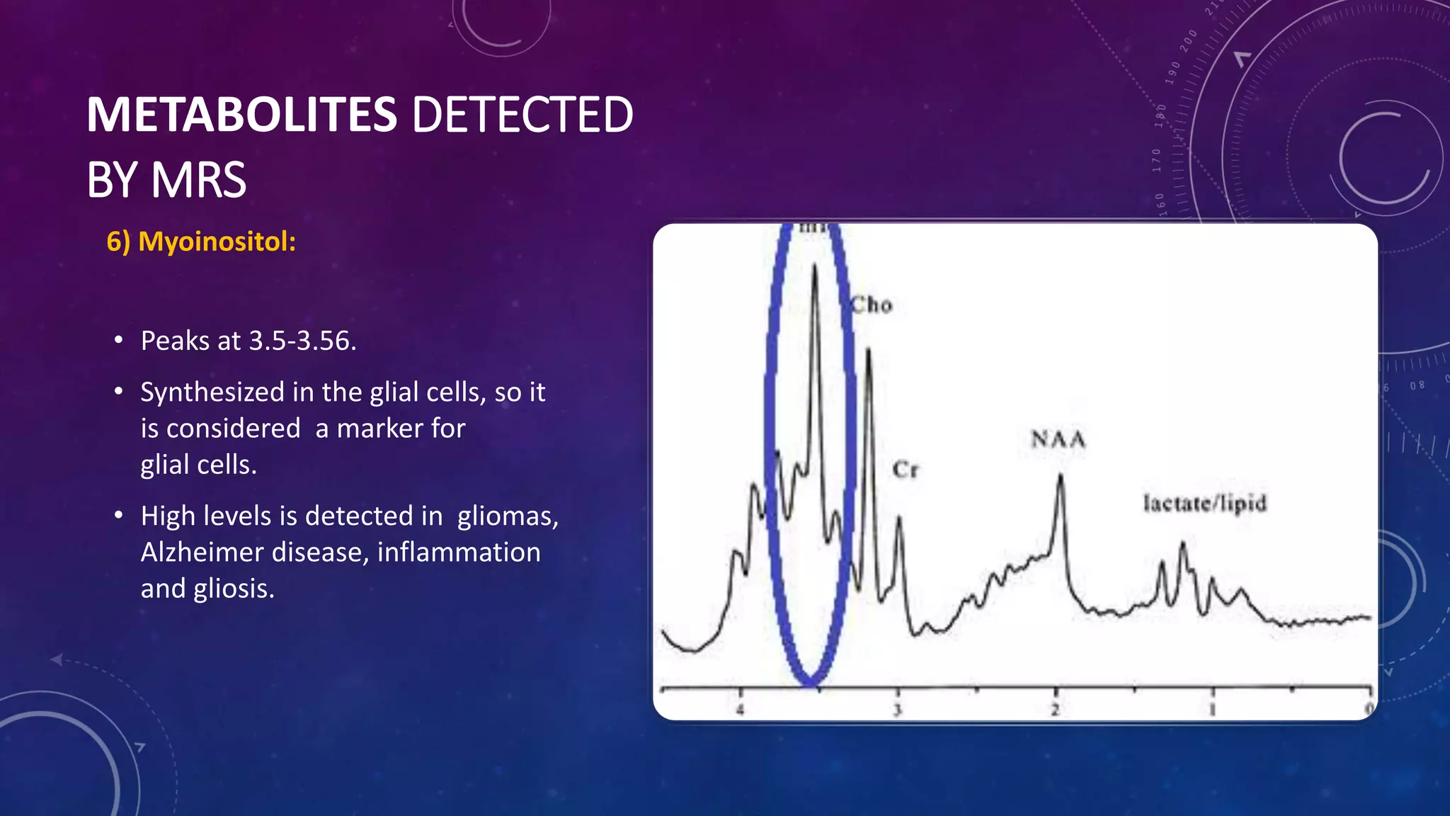 Magnetic resonance spectroscopy | PPTX