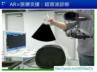 AR×医療支援：超音波診断
https://youtu.be/zI8S49qpiOs
 