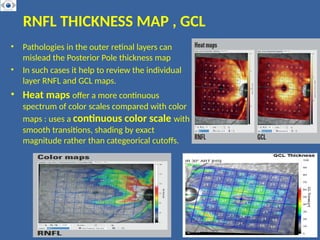 Normal Gcl Map MRW , RNFL . MINIMUM RIM WIDTH , RETINAL NERVE FIBRE LAYER ANALYSIS | PPTX
