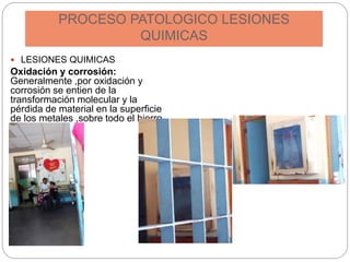 PROCESO PATOLOGICO LESIONES
QUIMICAS
 LESIONES QUIMICAS
Oxidación y corrosión:
Generalmente ,por oxidación y
corrosión se entien de la
transformación molecular y la
pérdida de material en la superficie
de los metales ,sobre todo el hierro
y el acero.
 