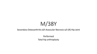 M/38Y
Secondary Osteoarthritis d/t Avascular Necrosis o/t (R) Hip Joint
Performed
Total hip arthroplasty
 