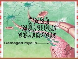 (MS)
 Multiple
Sclerosis
 