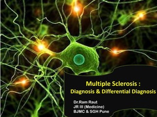 Multiple Sclerosis :
Diagnosis & Differential Diagnosis
Dr.Ram Raut
JR III (Medicine)
BJMC & SGH Pune

 