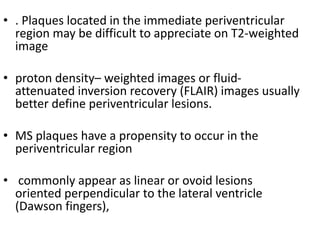 • . Plaques located in the immediate periventricular
region may be difficult to appreciate on T2-weighted
image
• proton density– weighted images or fluid-
attenuated inversion recovery (FLAIR) images usually
better define periventricular lesions.
• MS plaques have a propensity to occur in the
periventricular region
• commonly appear as linear or ovoid lesions
oriented perpendicular to the lateral ventricle
(Dawson fingers),
 