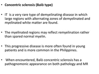• Concentric sclerosis (Balò type)
• IT is a very rare type of demyelinating disease in which
large regions with alternating zones of demyelinated and
myelinated white matter are found.
• The myelinated regions may reflect remyelination rather
than spared normal myelin.
• This progressive disease is more often found in young
patients and is more common in the Philippines.
• When encountered, Balò concentric sclerosis has a
pathognomonic appearance on both pathology and MR
 
