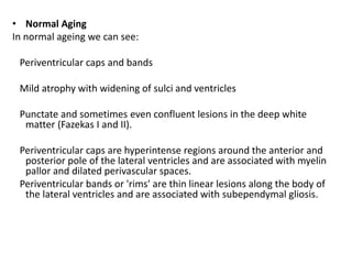 • Normal Aging
In normal ageing we can see:
Periventricular caps and bands
Mild atrophy with widening of sulci and ventricles
Punctate and sometimes even confluent lesions in the deep white
matter (Fazekas I and II).
Periventricular caps are hyperintense regions around the anterior and
posterior pole of the lateral ventricles and are associated with myelin
pallor and dilated perivascular spaces.
Periventricular bands or 'rims' are thin linear lesions along the body of
the lateral ventricles and are associated with subependymal gliosis.
 