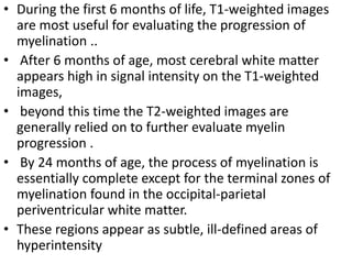 • During the first 6 months of life, T1-weighted images
are most useful for evaluating the progression of
myelination ..
• After 6 months of age, most cerebral white matter
appears high in signal intensity on the T1-weighted
images,
• beyond this time the T2-weighted images are
generally relied on to further evaluate myelin
progression .
• By 24 months of age, the process of myelination is
essentially complete except for the terminal zones of
myelination found in the occipital-parietal
periventricular white matter.
• These regions appear as subtle, ill-defined areas of
hyperintensity
 