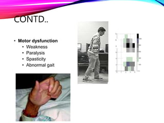 CONTD..
• Motor dysfunction
• Weakness
• Paralysis
• Spasticity
• Abnormal gait
 