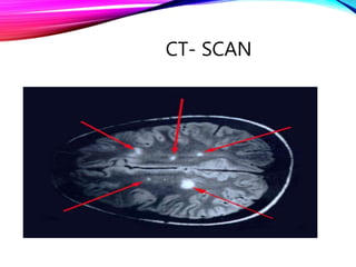 CT- SCAN
 
