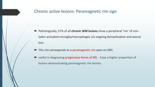 Ms. Sign Rim Multiple Sclerosis.pptx