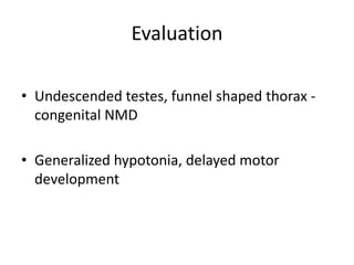 Evaluation

• Undescended testes, funnel shaped thorax -
  congenital NMD

• Generalized hypotonia, delayed motor
  development
 