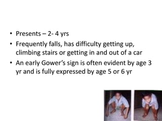 • Presents – 2- 4 yrs
• Frequently falls, has difficulty getting up,
  climbing stairs or getting in and out of a car
• An early Gower’s sign is often evident by age 3
  yr and is fully expressed by age 5 or 6 yr
 