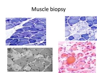 Muscle biopsy




                45
 