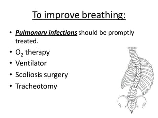 To improve breathing:
• Pulmonary infections should be promptly
  treated.
•   O2 therapy
•   Ventilator
•   Scoliosis surgery
•   Tracheotomy
 