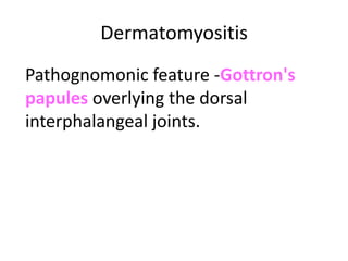 Dermatomyositis
Pathognomonic feature -Gottron's
papules overlying the dorsal
interphalangeal joints.
 