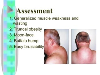 MS-Endo-Macel.ppt ENDOCRINE system including the health management of ...