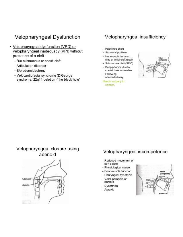 TREATMENT OF RESONANCE DISORDERS OPTIONS FOR THE NONMEDICAL SPEECH