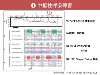Msa Sleep Sudden Death Ethics