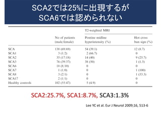SCA2:25.7%, SCA1:8.7%, SCA3:1.3%
Lee YC et al. Eur J Neurol 2009;16, 513-6
SCA2では25%に出現するが
SCA6では認められない
 