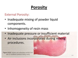 Porosity
External Porosity:
• Inadequate mixing of powder liquid
components.
• Inhomogeneity of resin mass
• Inadequate pressure or insufficient material
• Air inclusions incorporated during mixing
procedures.
138
 