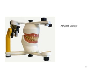 161
Acrylized Denture
 
