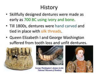 History
• Skillfully designed dentures were made as
early as 700 BC using ivory and bone.
• Till 1800s, dentures were hand carved and
tied in place with silk threads.
• Queen Elizabeth I and George Washington
suffered from tooth loss and unfit dentures.
5
 