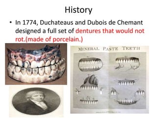 History
• In 1774, Duchateaus and Dubois de Chemant
designed a full set of dentures that would not
rot.(made of porcelain.)
6
 