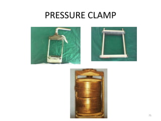 PRESSURE CLAMP
75
 