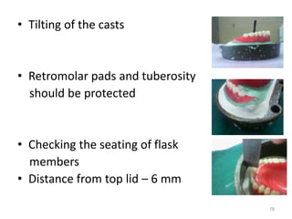 • Tilting of the casts
• Retromolar pads and tuberosity
should be protected
• Checking the seating of flask
members
• Distance from top lid – 6 mm
78
 