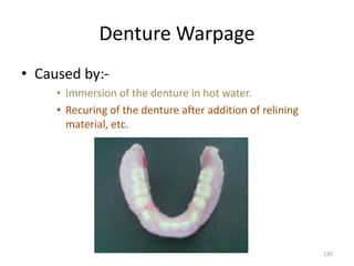 Denture Warpage
• Caused by:-
• Immersion of the denture in hot water.
• Recuring of the denture after addition of relinin...