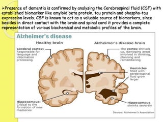 Presence of dementia is confirmed by analysing the Cerebrospinal fluid (CSF) with
established biomarker like amyloid beta protein, tau protein and phospho-tau
expression levels. CSF is known to act as a valuable source of biomarkers, since
besides in direct contact with the brain and spinal cord it provides a complete
representation of various biochemical and metabolic profiles of the brain.
 