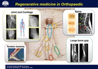 Università Campus Bio-Medico di Roma
Via Álvaro del Portillo, 21 - 00128 Roma - Italia
Joint and Cartilage
Large bone gap
Tendon lesions
Spine
Regenerative medicine in Orthopaedic
 