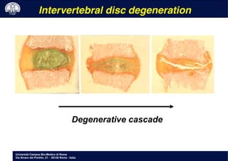 Università Campus Bio-Medico di Roma
Via Álvaro del Portillo, 21 - 00128 Roma - Italia
Intervertebral disc degeneration!
Degenerative cascade
 
