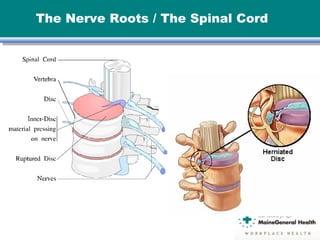 The Nerve Roots / The Spinal Cord
 