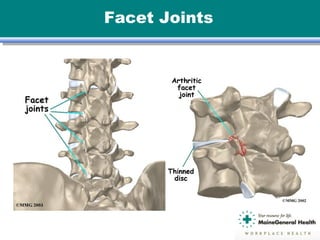 Facet Joints
 