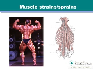Muscle strains/sprains
 