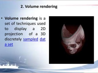 Pmct Volume Rendering MDCT (2) | PPTX