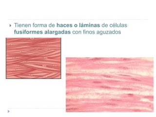  Tienen forma de haces o láminas de células
fusiformes alargadas con finos aguzados
 