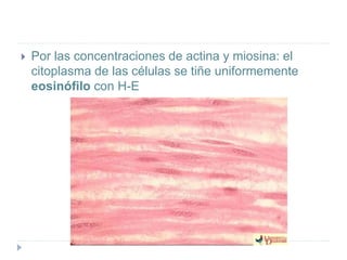  Por las concentraciones de actina y miosina: el
citoplasma de las células se tiñe uniformemente
eosinófilo con H-E
 
