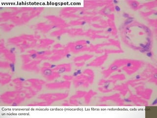 Corte transversal de músculo cardiaco (miocardio). Las fibras son redondeadas, cada una con
un núcleo central.
 