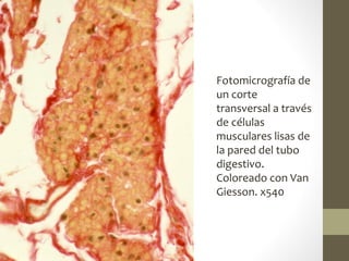 Fotomicrografía de
un corte
transversal a través
de células
musculares lisas de
la pared del tubo
digestivo.
Coloreado con Van
Giesson. x540
 