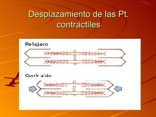 Desplazamiento de las Pt.
      contráctiles
 